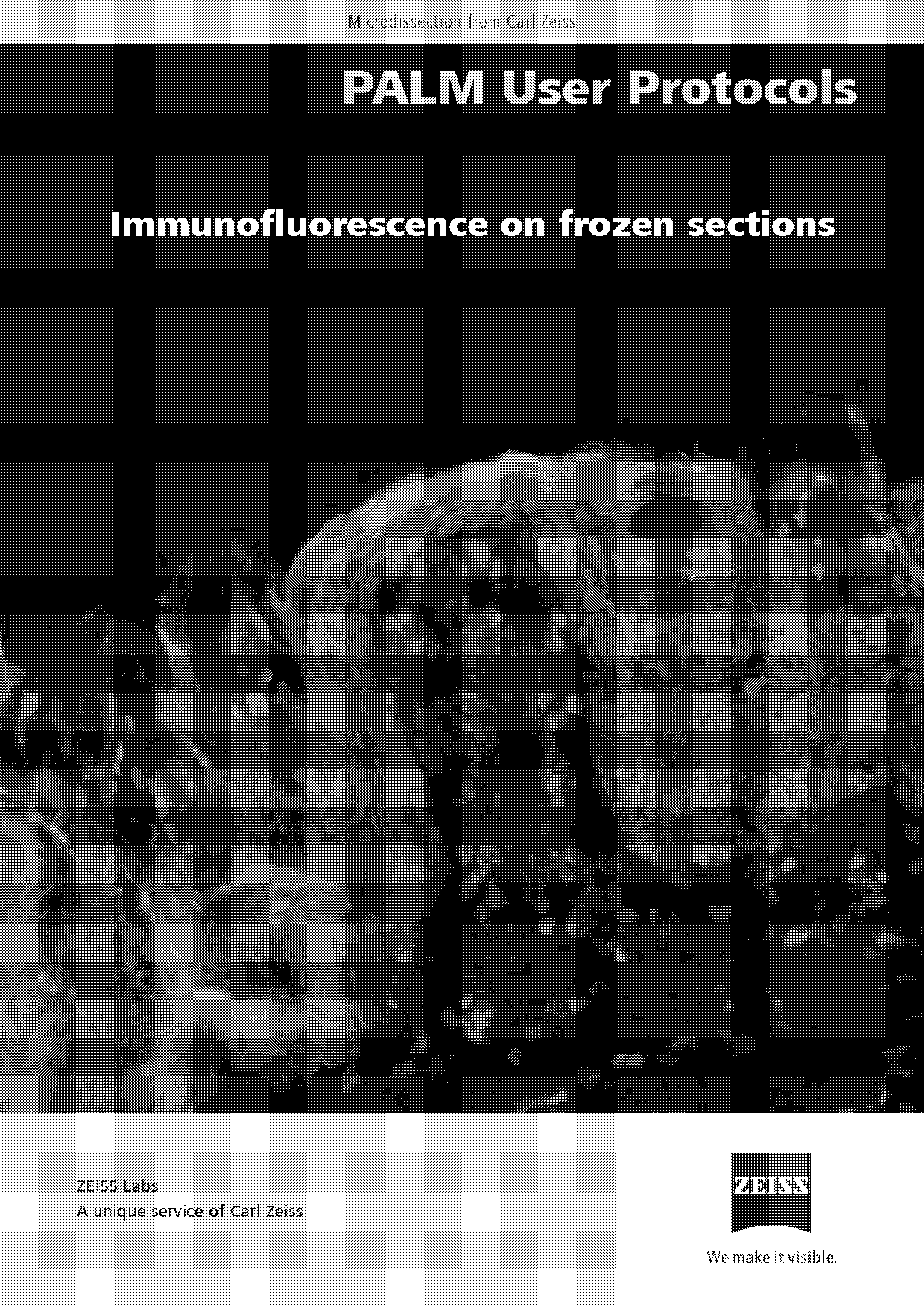 immunofluorescence staining protocol for frozen section